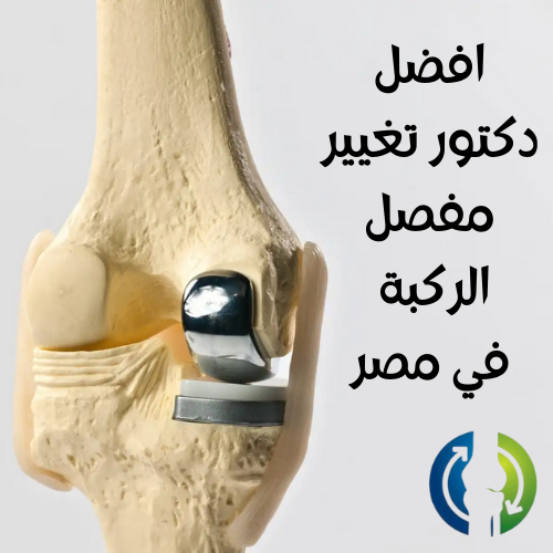 افضل دكتور تغيير مفصل الركبة في مصر