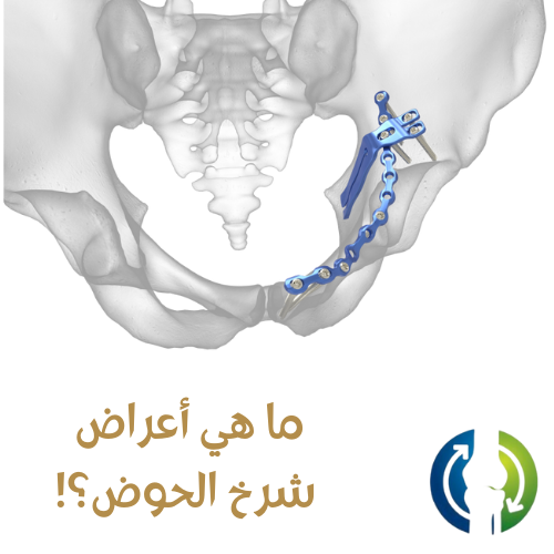 ماهى أعراض شرخ الحوض